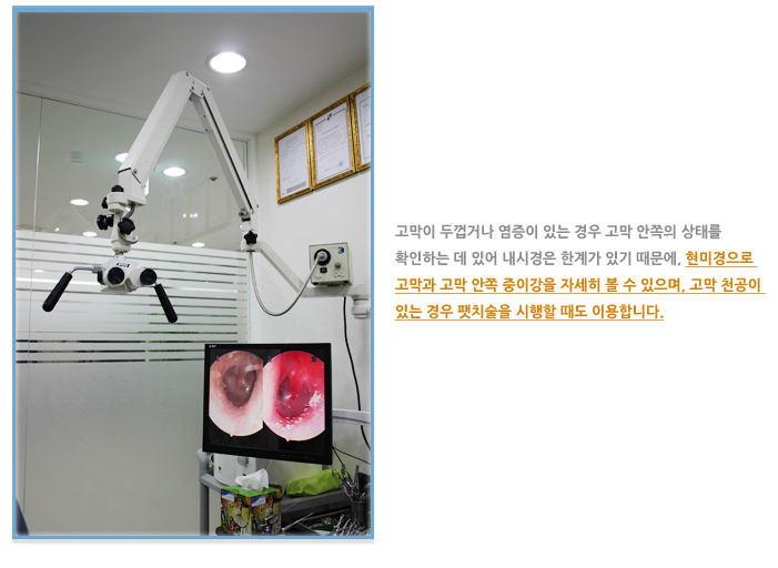 고막 현미경 검사