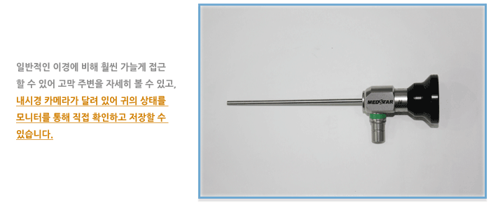 귀 내시경 검사