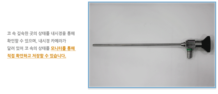 비강 내시경 검사