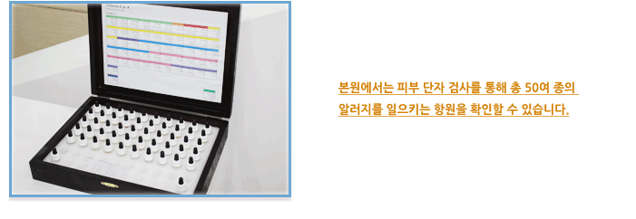 알러지(알레르기) 검사