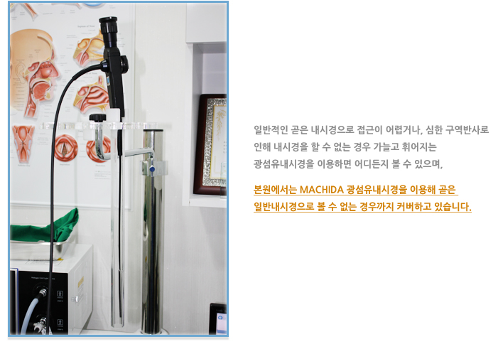 첨단 광섬유 내시경 검사