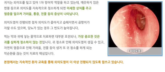 외이도염