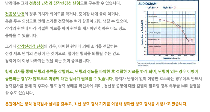 난청 및 이명