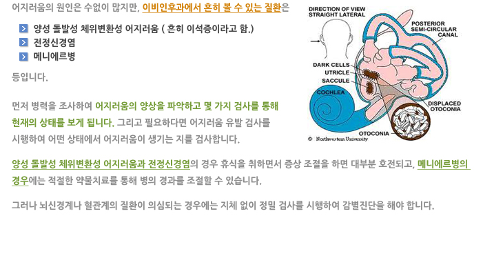 어지럼증