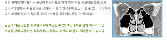 만성 비염