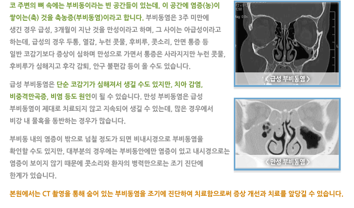 축농증(부비동염)