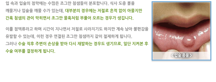 구강/입술 질환