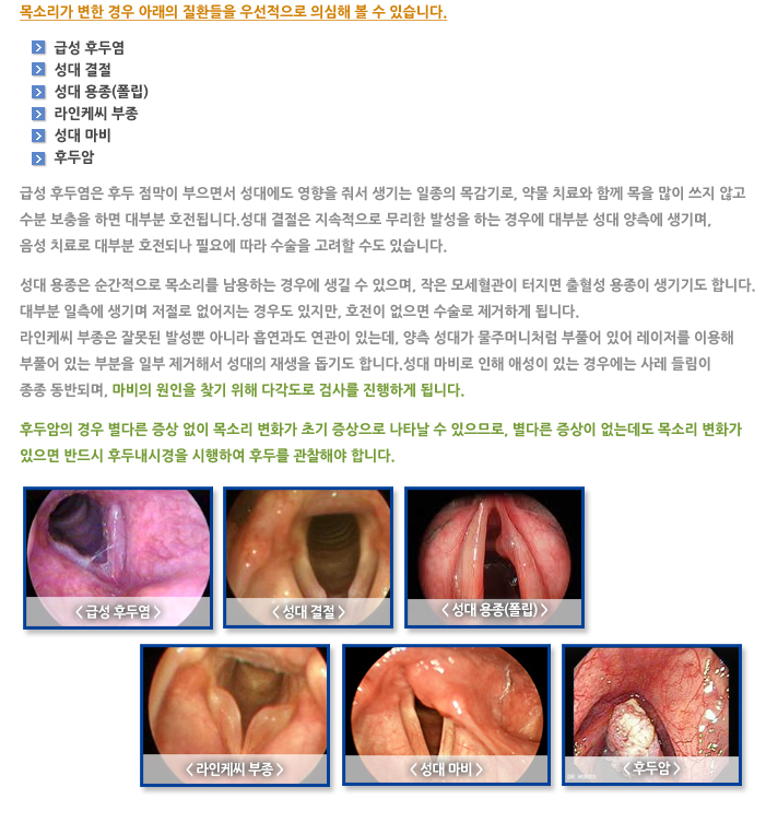 애성(쉰 목소리)