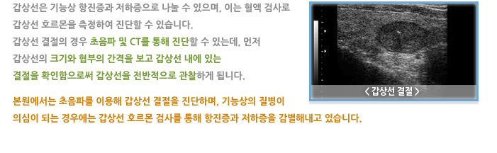갑상선 질환