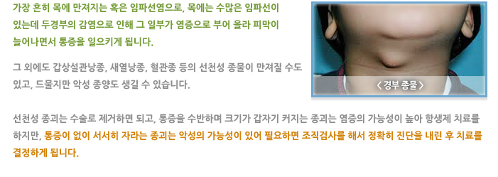 경부 종물(목에 생긴 혹)