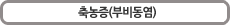 축농증(부비동염)