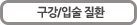 구강/입술 질환