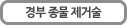 경부 종물 제거술