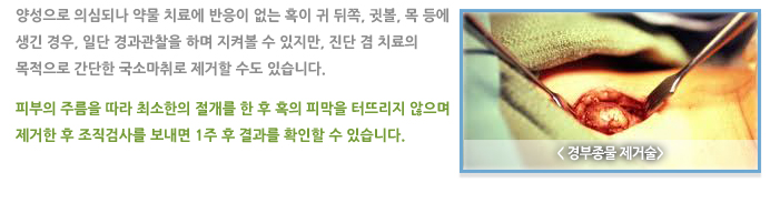 경부 종물 제거술